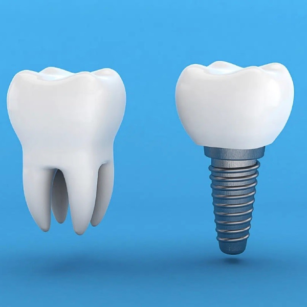 how-long-after-tooth-extraction-should-be-implanted