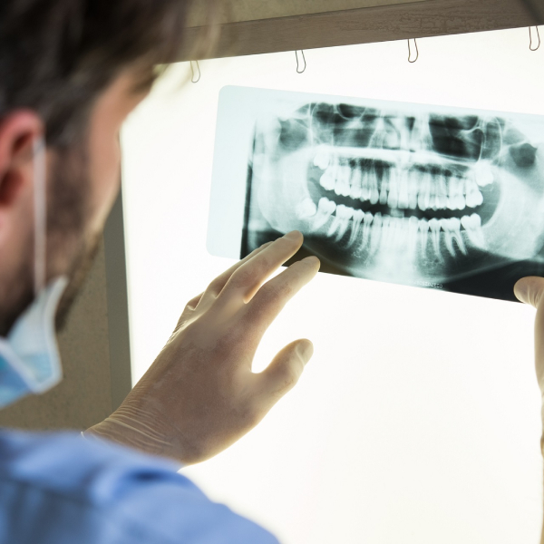 dental-x-ray
