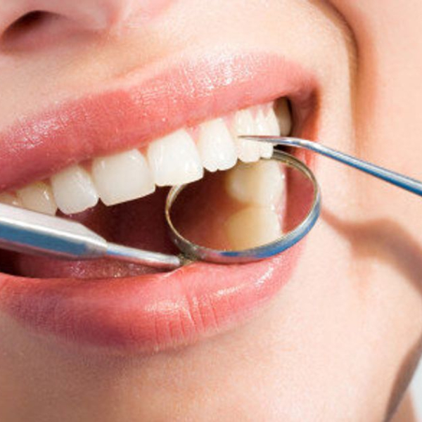 care-after-tooth-filling