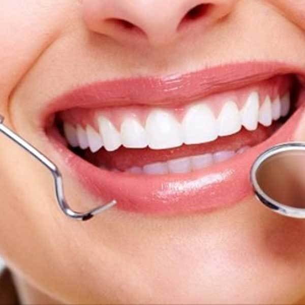 بهترین دندانپزشک در ونک