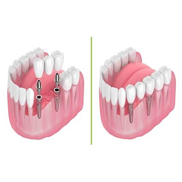 بهترین مطب دندانپزشکی در ونک
